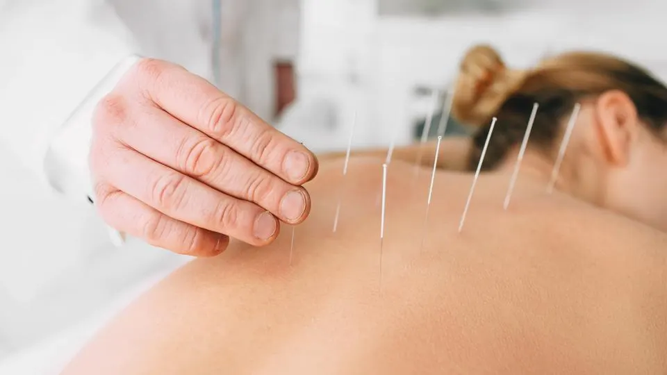 acupunctura shanxi